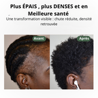 Le Roll-On Anti-Chute Révolutionnaire aux 4 Actifs Premium