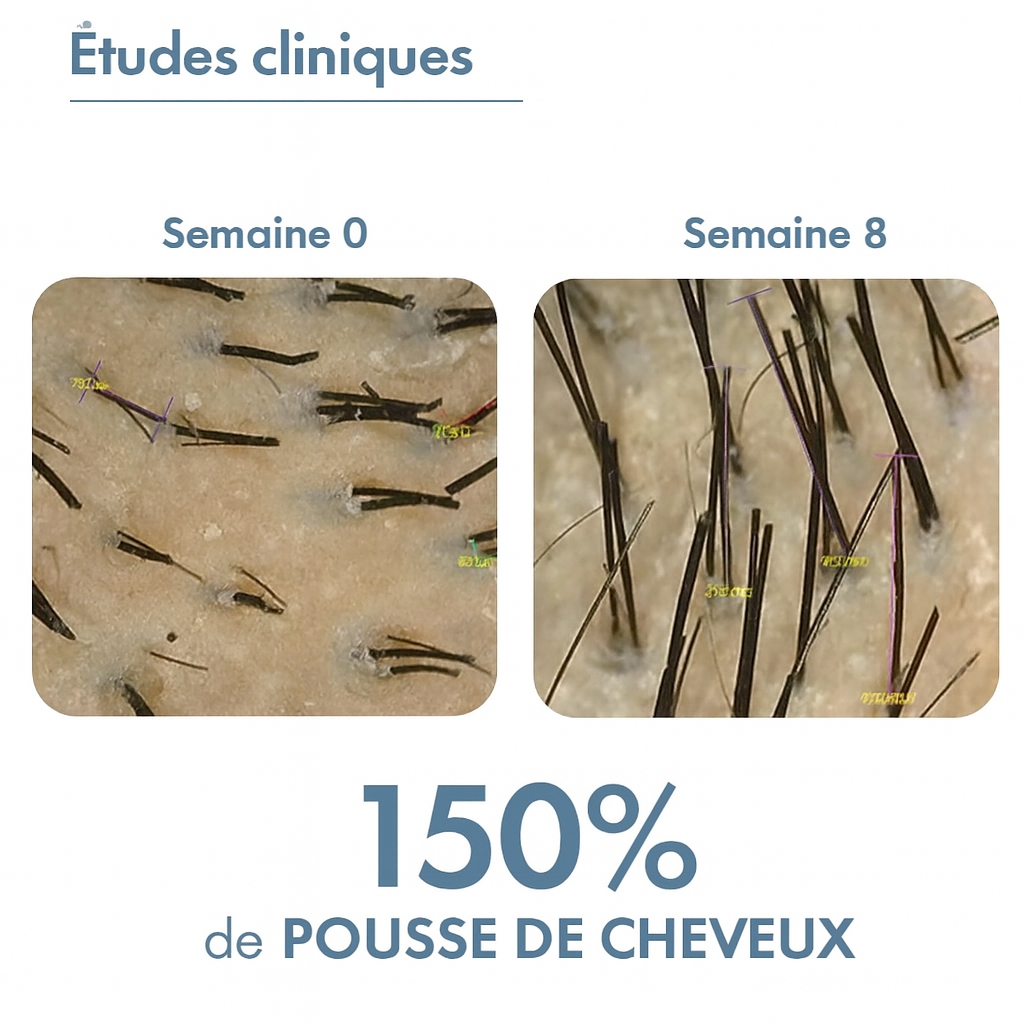 Le Roll-On Anti-Chute Révolutionnaire aux 4 Actifs Premium