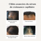 Le Roll-On Anti-Chute Révolutionnaire aux 4 Actifs Premium