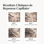 Le Roll-On Anti-Chute Révolutionnaire aux 4 Actifs Premium