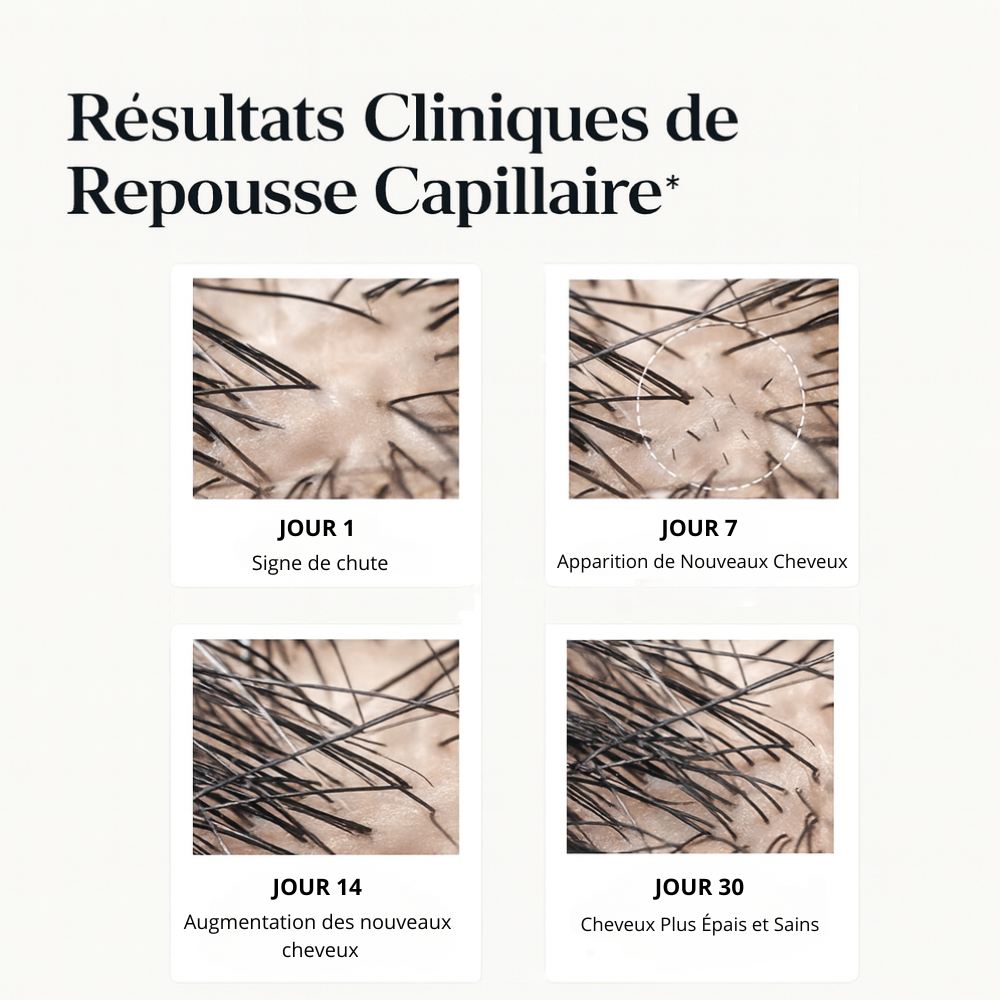 Le Roll-On Anti-Chute Révolutionnaire aux 4 Actifs Premium